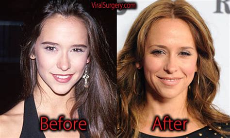 jennifer love hewitt implants|Jennifer Love Hewitt Responds to Plastic Surgery。